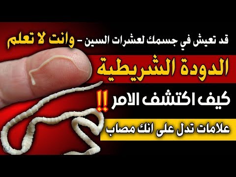 الدودة الشريطية علامات تدل على انها تعيش في جسدك -كيف اكتشف الامر؟ - سبل العلاج والوقاية منها