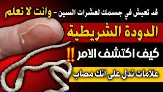 الدودة الشريطية علامات تدل على انها تعيش في جسدك -كيف اكتشف الامر؟ - سبل العلاج والوقاية منها