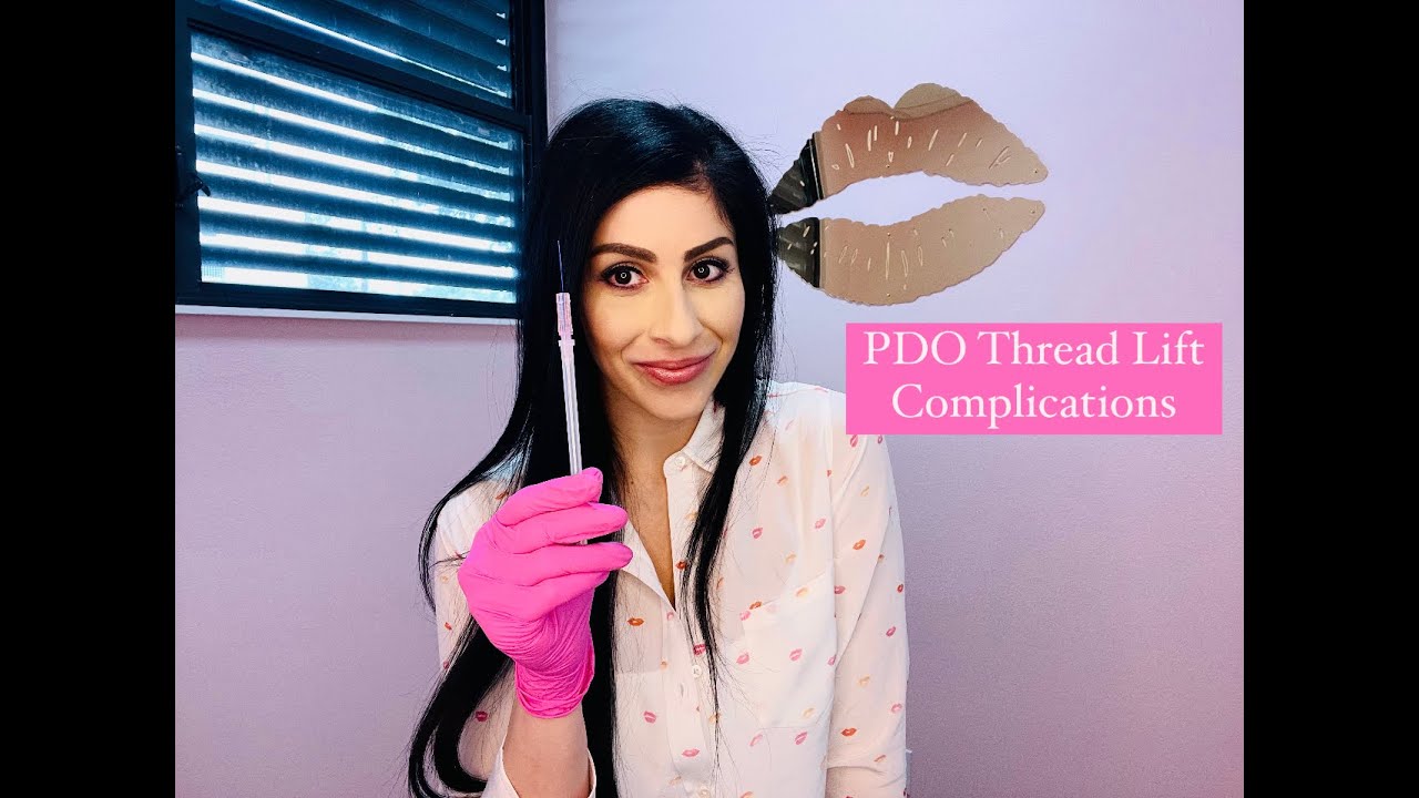 Thread Lift Complications YouTube