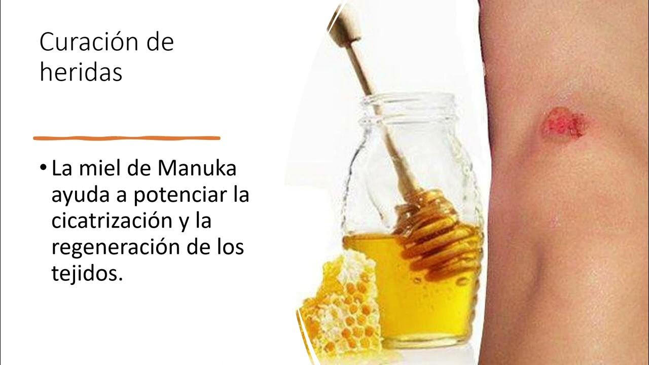 MIEL MANUKA PREMIUM DE ATOMY! YA ESTA AQUI!!!! - YouTube