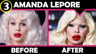 Amanda Lepore Plastic Surgery