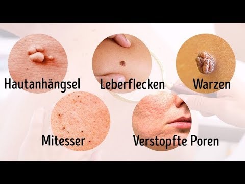 8 schwere Krankheiten, die deine Haut sichtbar macht