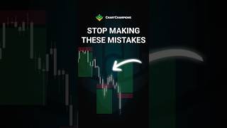 Stop Round-Tripping Your Trades!