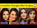 20 turkish actresses before and after surgery  plastic surgery turkish drama