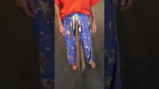 Balance on MS patient