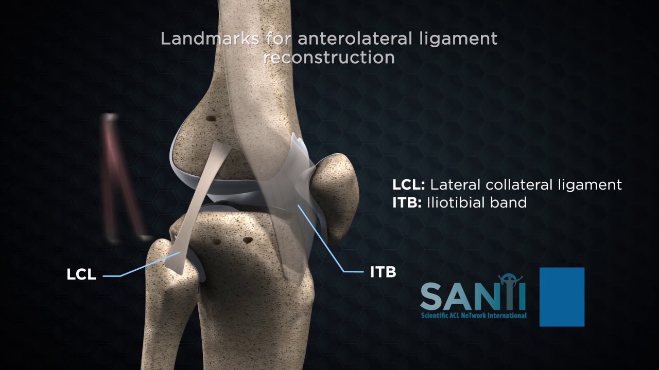 Myron térd ligamentum károsodás,