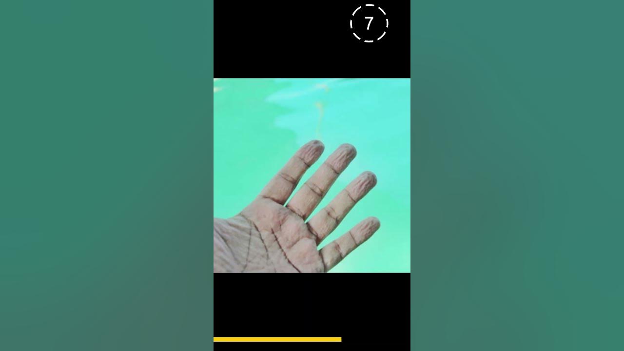 "Waterlogged Fingers The Science Behind Wrinkly Skin" facts 
