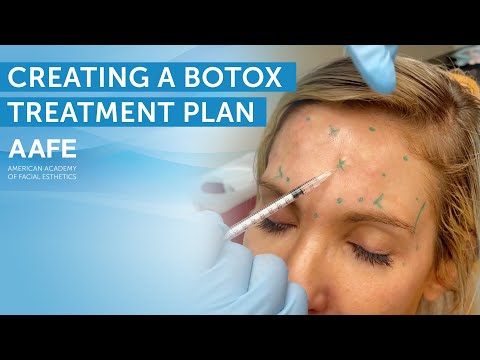 Video: Paprasti būdai, kaip išmokti administruoti Botox: 14 žingsnių (su nuotraukomis)