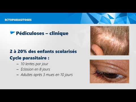 Conftube ECNi #82 - Infections parasitaires de la peau - Topo Conftube ECNi #82 - Infections parasitaires de la peau - Topo