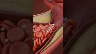 Stemi Explained Why Paramedics Administer Asa