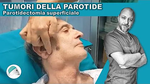 Dove operare adenoma Pleomorfo?