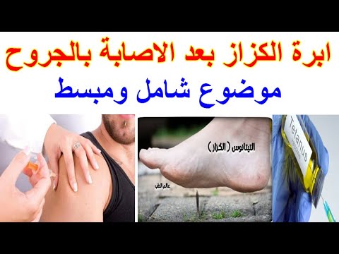إبرة الكزاز اين ومتى وكيف تحقن