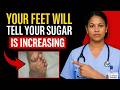 Doctors Warn: 8 Warning Signs in Your Feet That Could Mean Diabetes (NEVER Ignore!)