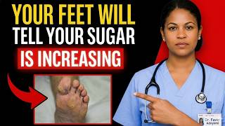 Doctors Warn: 8 Warning Signs in Your Feet That Could Mean Diabetes (NEVER Ignore!)