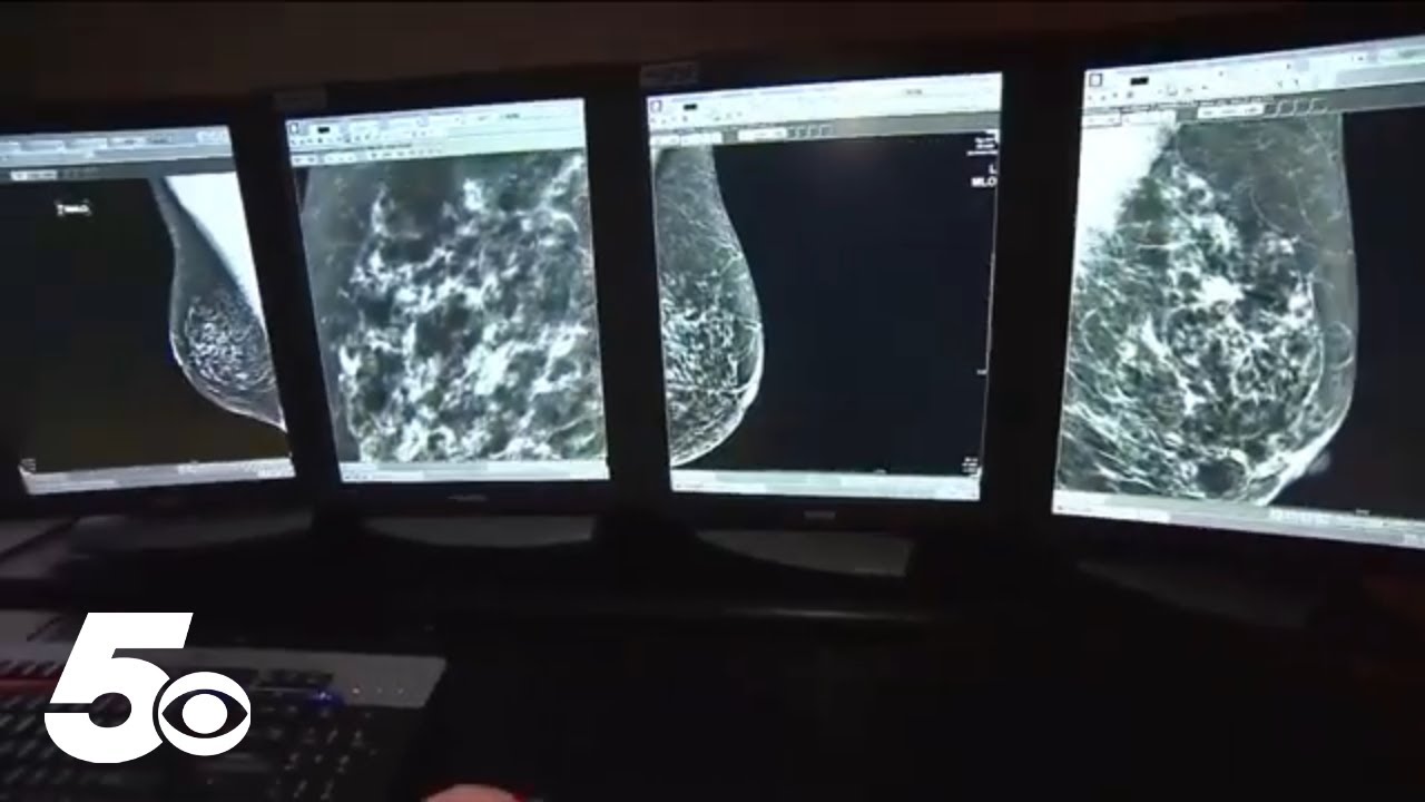 New FDA rule will ensure all women have breast density report