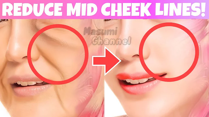 Anti-Aging Face Lifting Exercises For Laugh Lines, Middle Cheek Lines (Nasolabial Folds/ Smile Line)