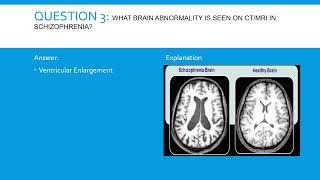 High Yield Psychiatry Review For Usmlecomlex- Episode 1