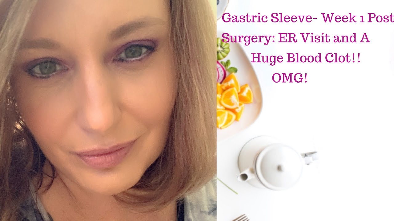 VSG Gastric Sleeve One Week Post Op Ended Up in the ER w/ A HUGE Blood