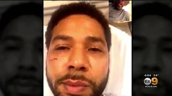 'Empire' Actor Jussie Smollett May Face Felony Charge In Alleged Attack
