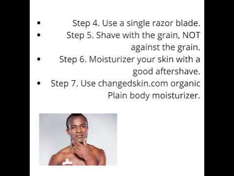 How Can Black Men Treat Razor Bumps? 