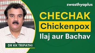 Chechak (Chickenpox): Lakshan, Ilaj aur Bachav | Varicella-Zoster Virus in Hindi | Dr KK Tripathy