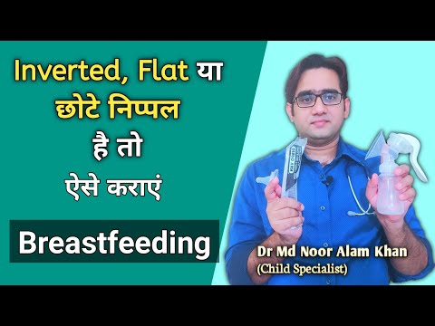 वीडियो: सूजी हुई पलकों से कैसे छुटकारा पाएं: १५ कदम