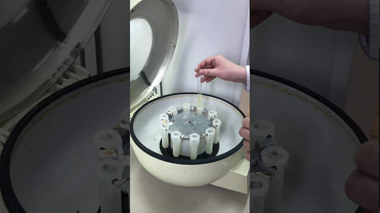 Qualitative determination of uranium. (NH4)4[UO2(CO3)3]+H2O (Mixing and filtration)