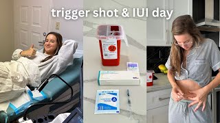 OUR FIRST IUI PROCEDURE | Follicle count, Trigger shot, double IUI day! | TTC journey month 15