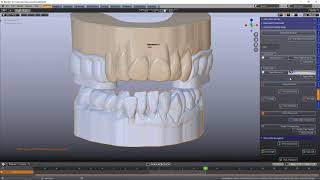 B4D Splint