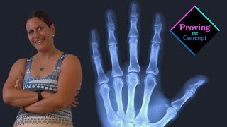 X-Ray-Ted: The Science of X-Rays & X-Ray Crystallography | How We See the Invisible