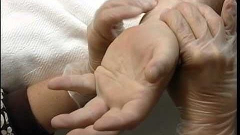 How to perform a Modified Allen Test