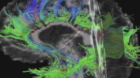 An Overview of and Introduction to the Cingulum