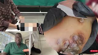 🔴JIM RUS 😱🦶 𝐄𝐱𝐭𝐫𝐞𝐦𝐞 𝐉𝐢𝐠𝐠𝐞𝐫 𝐑𝐞𝐦𝐨𝐯𝐚𝐥 Professional Pedicure DR LEE’S ULTIMATE ZITPOPPER #EB3991