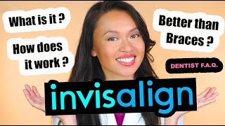 Invisalign Treatment What Are Invisalign Clear Aligners Dentist F.a.q.