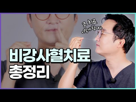 [비강사혈 총정리] 코 안에 맞는 침?! 비강사혈 치료란?  ft. 효과, 통증, 어린이 비강사혈