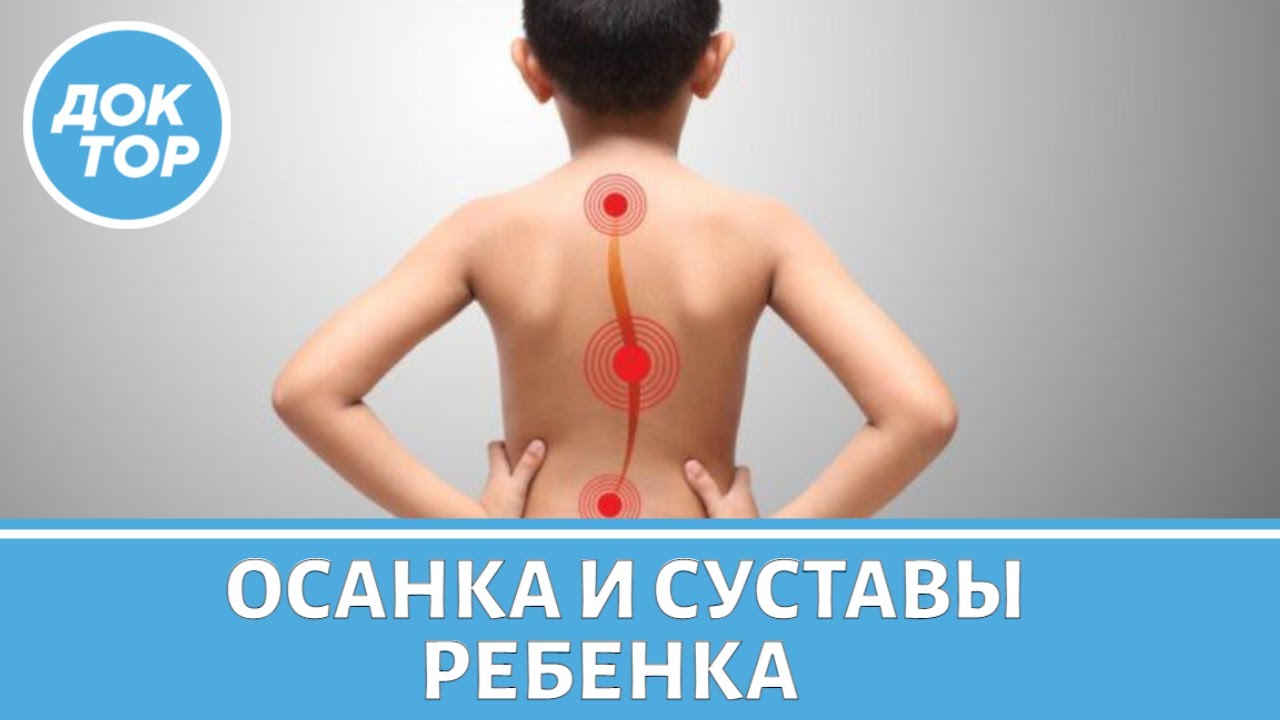 Как понять, что у ребенка нарушение осанки и гипермобильность суставов