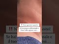 Come Ti Accorgi Se Si Ha Il Diabete Shorts Come Ti Accorgi Se Si Ha Il Diabete Shorts