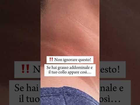 Come Ti Accorgi Se Si Ha Il Diabete Shorts