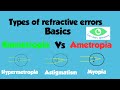 Emmetropia  ametropia different types of refractive errorsmyopia hypermetropiaastigmatism