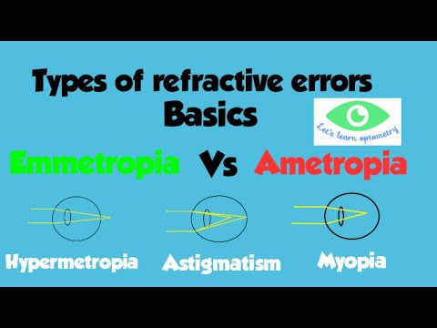 Emmetropia & Ametropia/ Different types of refractive errors/Myopia/ Hypermetropia/Astigmatism