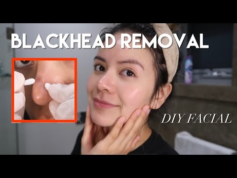 Full facial & extraction at home (DIY blackhead removal)