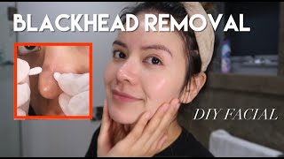 Full facial & extraction at home (DIY blackhead removal)