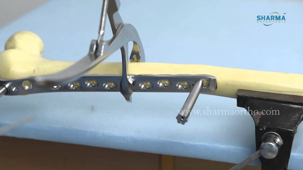 Proximal Femur Locking Plate