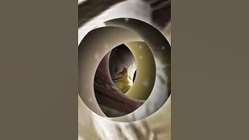 Mỹ Đỗ Toa , Tiêu Tiêu # tiêu viêm # mỹ đỗ toa # đấu phá thương khung