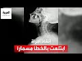 امرأة في بيرو تبتلع عن طريق الخطأ مسمارا امرأة في بيرو تبتلع عن طريق الخطأ مسمارا