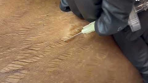 THE PERFECT PAIR FOR STRETCH MARKS