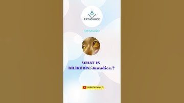 𝙬𝙝𝙖𝙩 𝙞𝙨 𝘽𝙞𝙡𝙡𝙞𝙧𝙪𝙗𝙞𝙣/𝙟𝙖𝙪𝙣𝙙𝙞𝙘𝙚.#bilirubin#jaundice#newborn#liver#conjugatedbilirubin#unconjugated #tdi