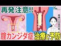 再発注意！膣カンジダ症の治療と予防について産婦人科の専門医が徹底解説