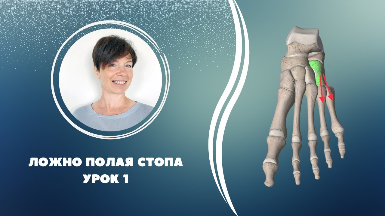 Ложно полая стопа
