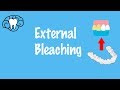 External Bleaching